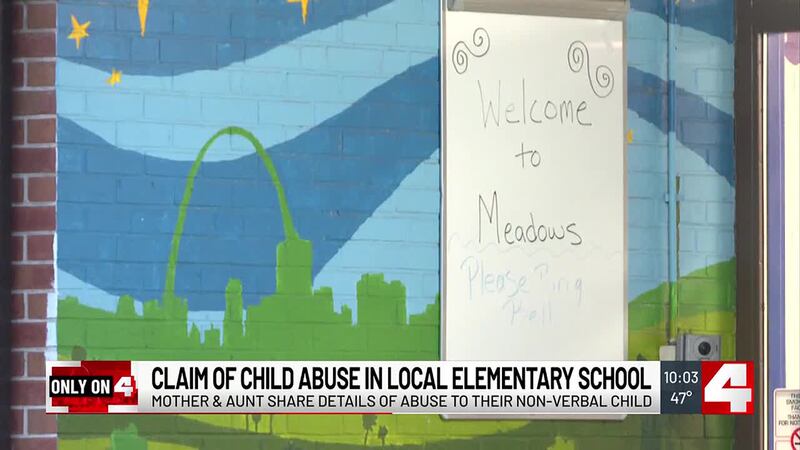 Special School District employee on leave after family says she abused non-verbal, autistic child