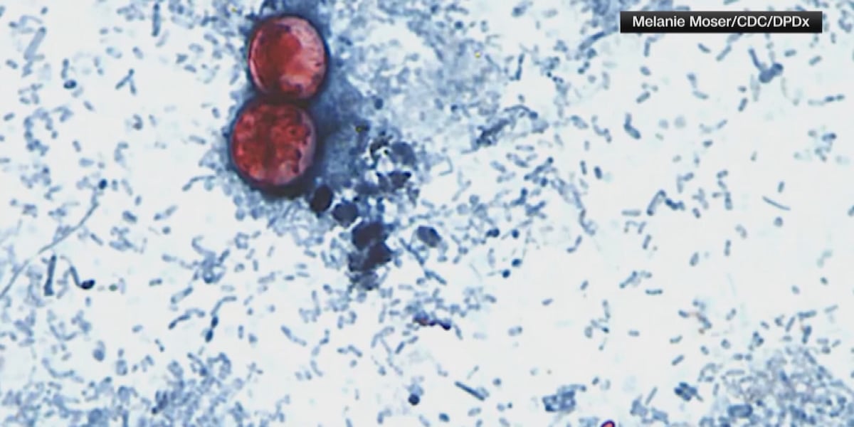 Missouri reports third-most cyclospora cases in nation as outbreak slows