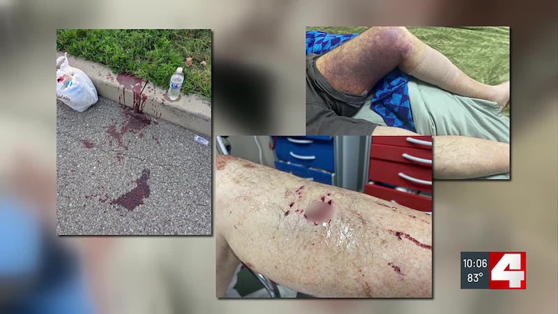 Loose pit bulls tear into elderly man in Forest Park, police still searching for owner