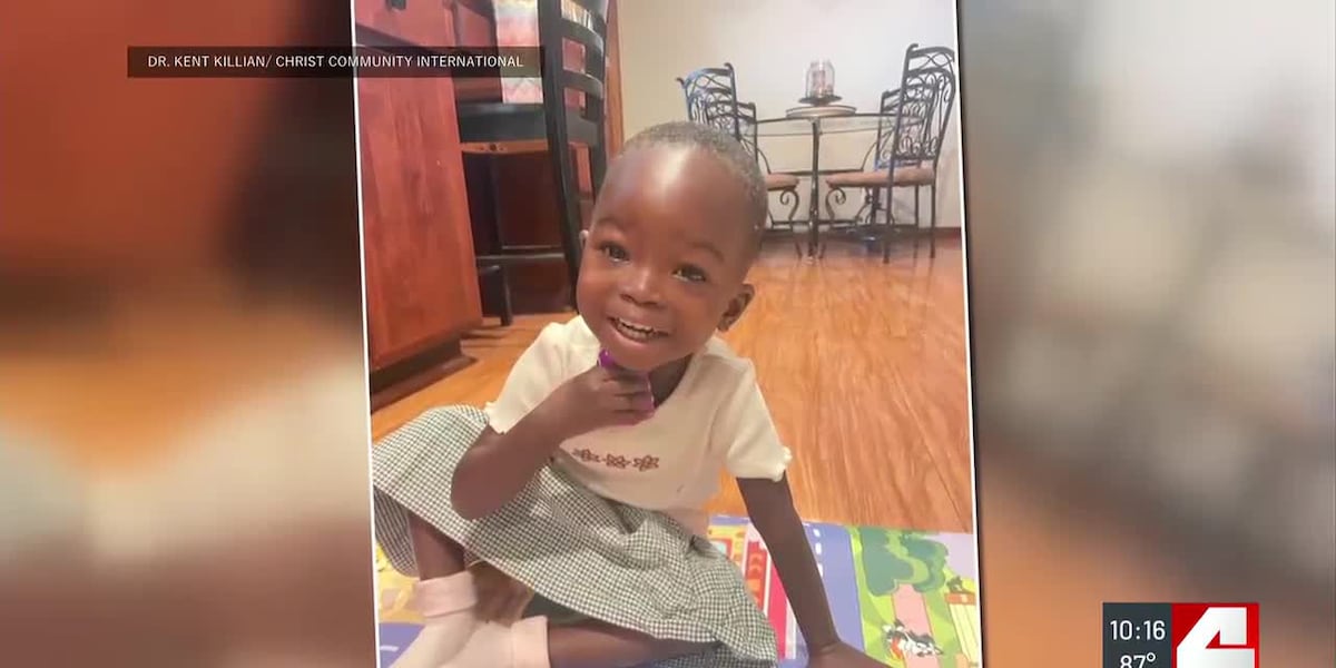 2-year-old flown from Uganda to St. Louis for life-saving surgery