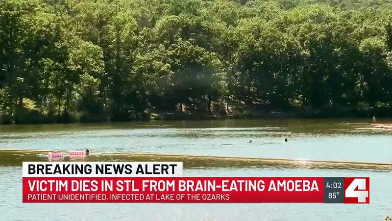 The Missouri Department of Health and Senior Services (DHSS) confirmed that a person has died...